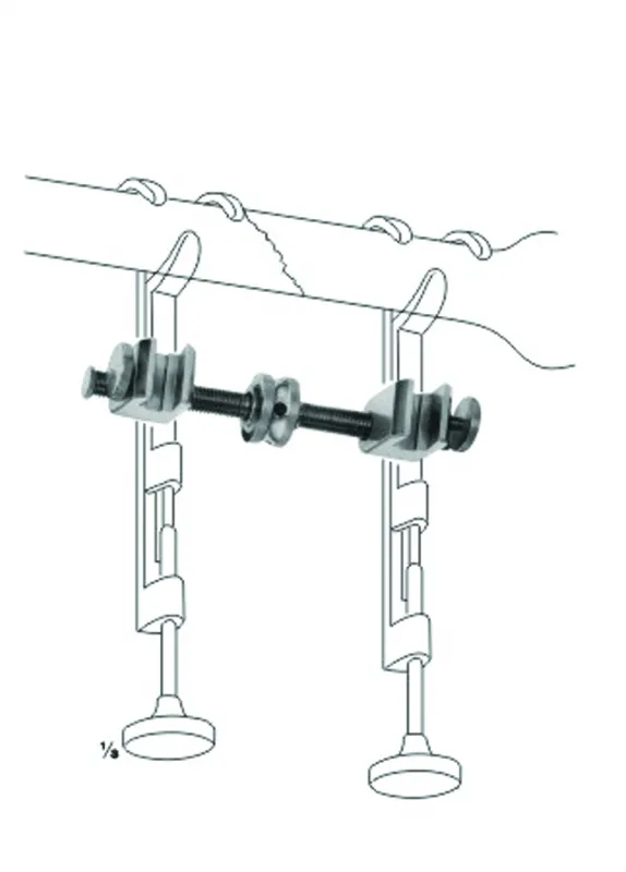 Bone Clamps